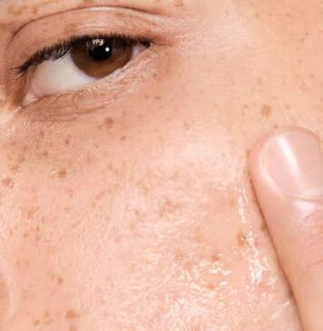 💦 Oily Skin Care Tips: How to Control Shine & Get a Healthy Glow Oile skin